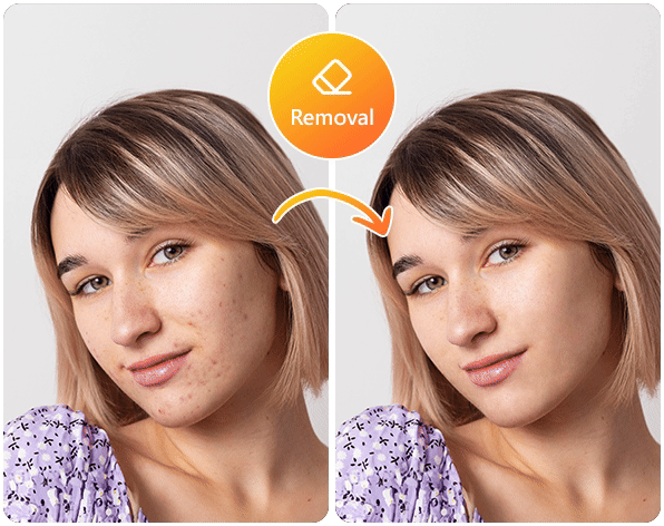 Remove a Person From a Photo Online with MyEdit
