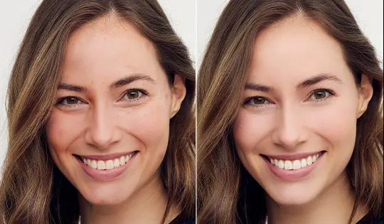 手機P圖柔膚效果