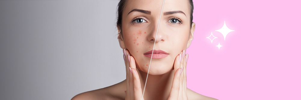 Meilleures Applications de Retouche Photo Visage