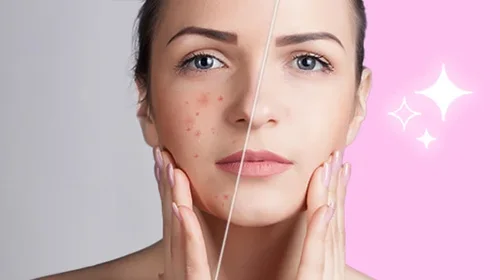 Die besten Face-Apps: Mit KI Gesicht und Körper verschönern