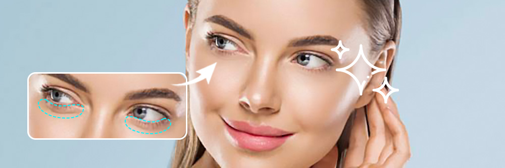 How To Get Rid of Bags Under Eyes 