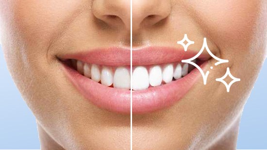 10 Ways to Whiten Teeth Naturally