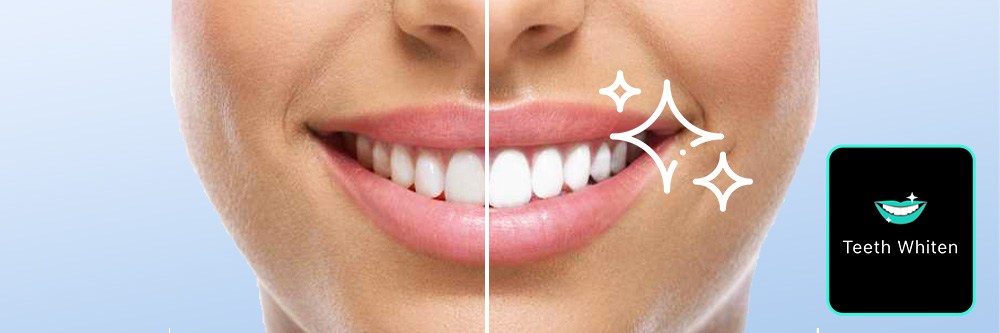 10 Ways to Whiten Teeth Naturally