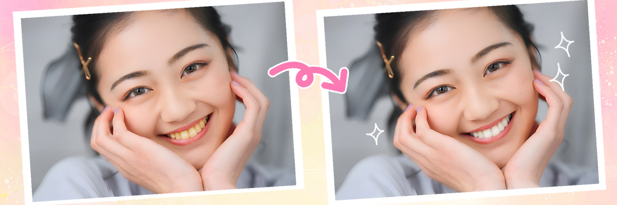 牙齒美白
