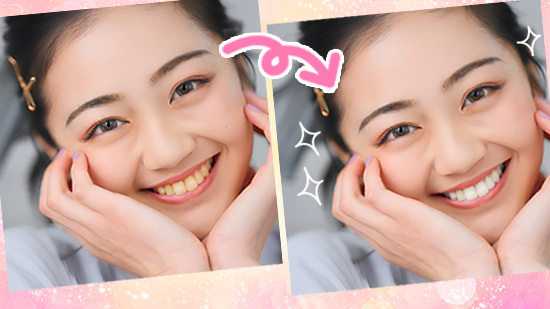 迅速擺脫黃牙!特搜10大牙齒美白方法 & 6款牙齒美白App推薦