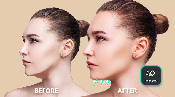The Ultimate Guide for How to Achieve Double Chin Removal in Seconds