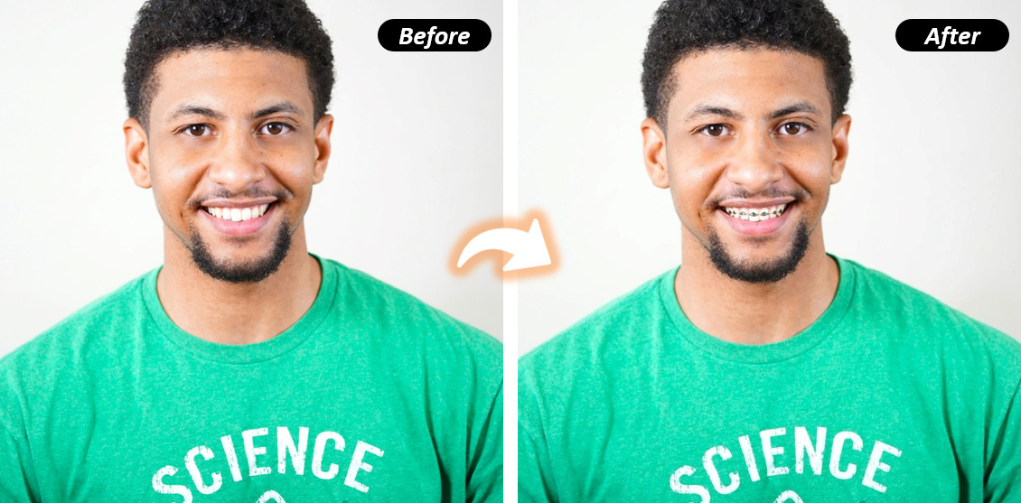 PhotoDirector - Braces Filter PhD PC