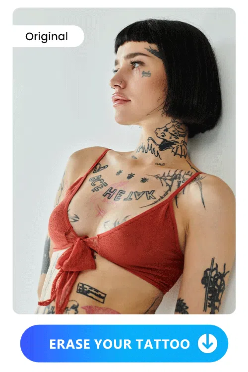 MyEdit - Online tattoo removal