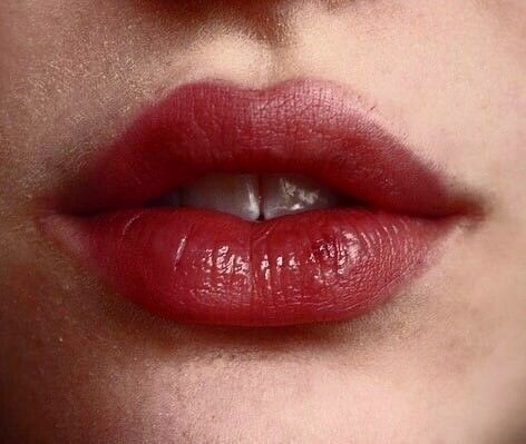 Popular Lip Filler Shapes: Heart-Shaped Lips