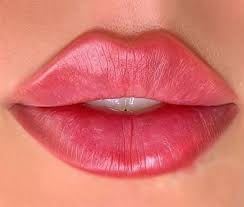 Popular Lip Filler Shapes: Russian Lips