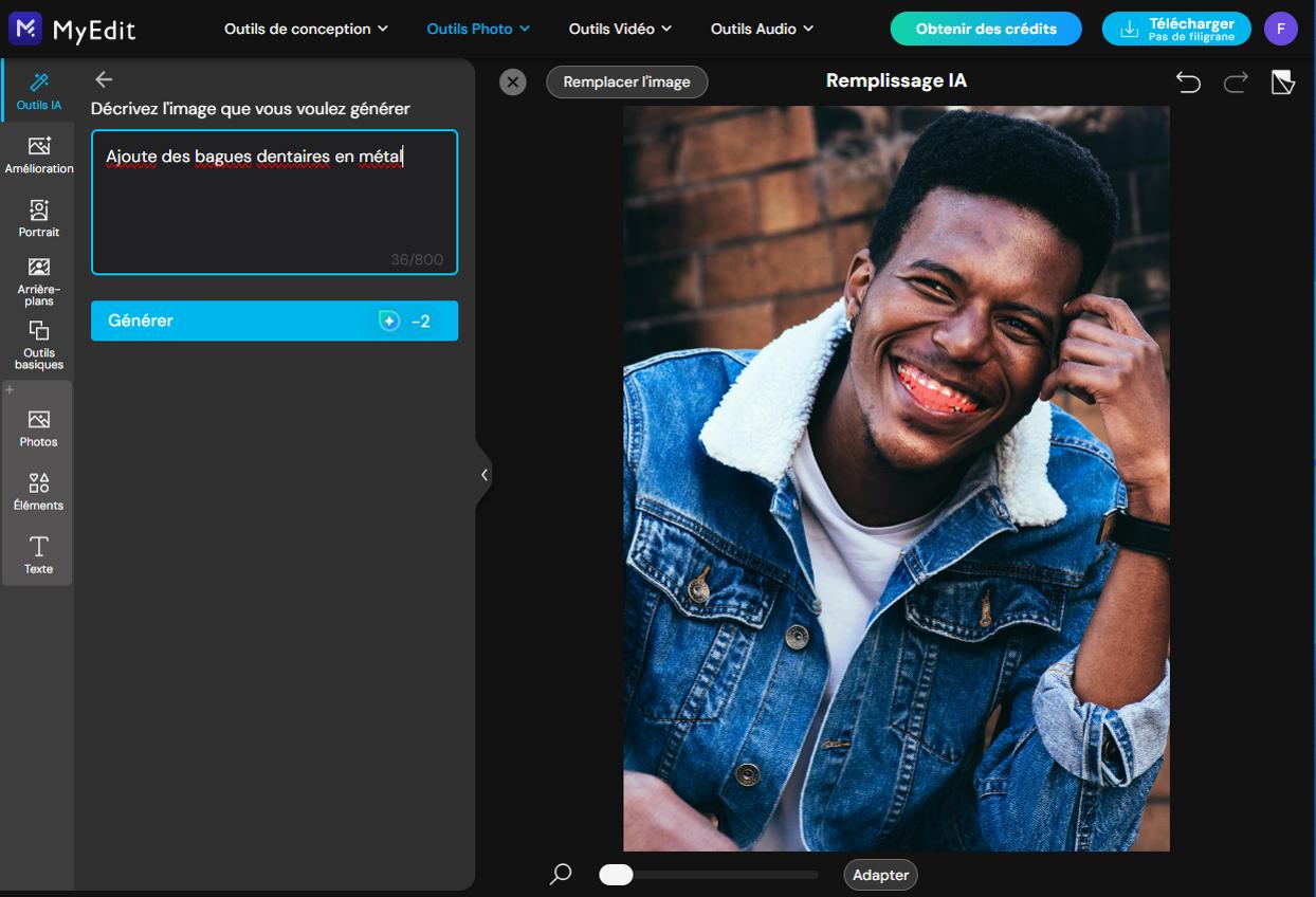 MyEdit - Tutoriel ajout de filtre appareil dentaire