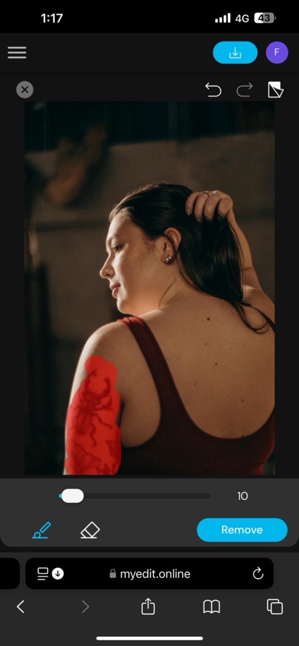 MyEdit — Best for Fast & Realistic Tattoo Removal