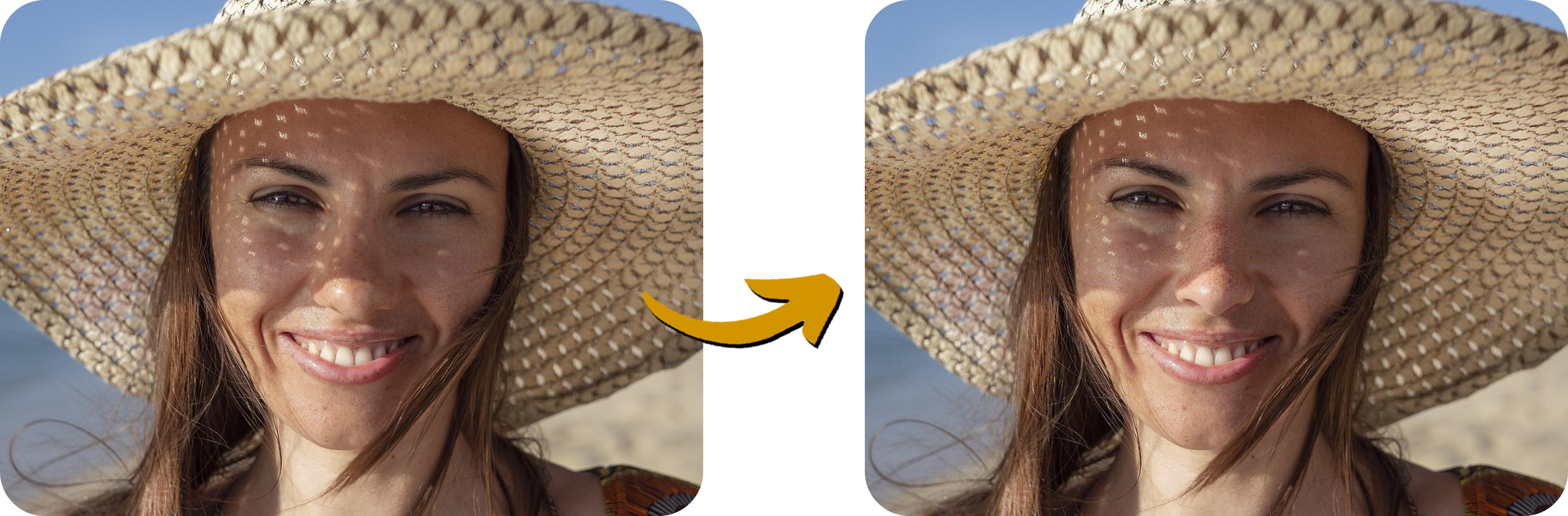 Comment utiliser un simulateur de rhinoplastie en ligne