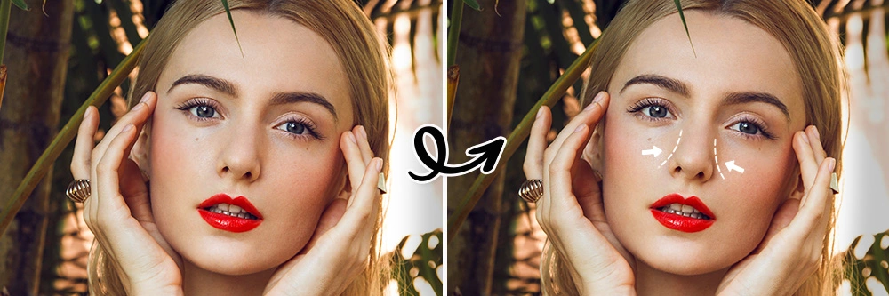 Meilleur simulateur de nez Rhinoplastie