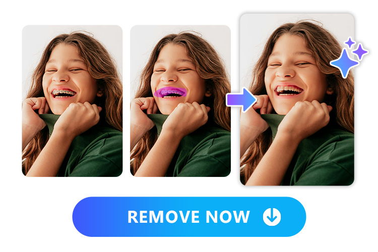 Erase Brace from Pictures