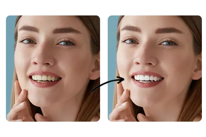 Whiten and Brighten Your Smile