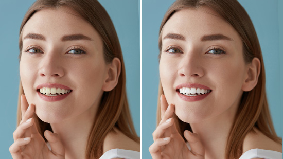 How to Whiten Teeth in Photos for Free [Windows, Mac]