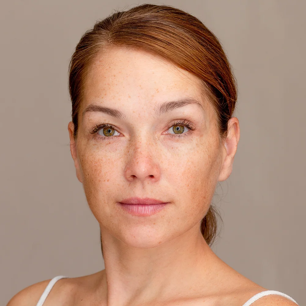 Close-up portrait of a woman with freckles across her forehead, nose, and cheeks against a plain background