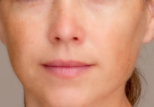 The same close-up after Skin Smoother, with smoother skin, faint freckles, and the lips unchanged